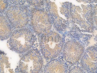 Integrin  alpha V Recombinant Rabbit mAb - BF3951 at 1/100 staining Mouse testicular tissue by IHC-P.
