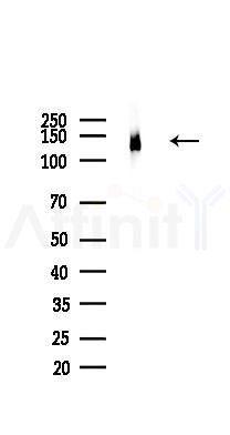 Integrin  alpha V Recombinant Rabbit mAb - Western blot analysis of lysates from Mouse brain, using Integrin  alpha V Recombinant Rabbit mAb at 1/1000 dilution.
