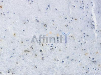 CDK6 Recombinant Rabbit mAb - BF3952 at 1/100 staining Human brain tissue by IHC-P.