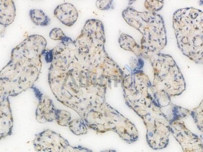 CDK6 Recombinant Rabbit mAb - BF3952 at 1/100 staining Human placental tissue by IHC-P.