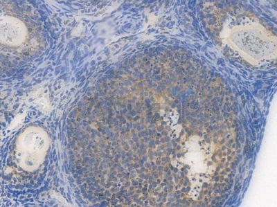eIF2A Recombinant Rabbit mAb - BF3954 at 1/100 staining Mouse ovarian tissue by IHC-P.