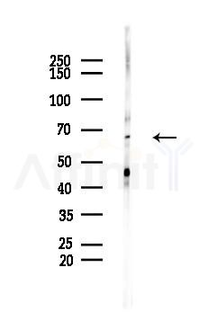 eIF2A Recombinant Rabbit mAb - Western blot analysis of lysates from Mouse testis, using eIF2A Recombinant Rabbit mAb at 1/1000 dilution.