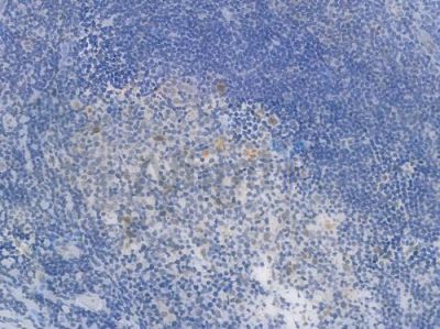 Phospho-STAT1 (Ser727) Recombinant Rabbit mAb - BF3955 at 1/100 staining Human tonsil tissue by IHC-P.