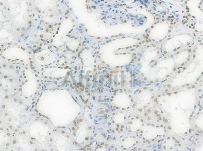 Phospho-STAT1 (Ser727) Recombinant Rabbit mAb - BF3955 at 1/100 staining Human renal tissue by IHC-P.