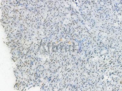 Acetyl-Histone H3 (Lys27) Recombinant Rabbit mAb - BF3958 at 1/100 staining Human spleen tissue by IHC-P.