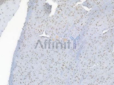 Acetyl-Histone H3 (Lys27) Recombinant Rabbit mAb - BF3958 at 1/100 staining Mouse brain tissue by IHC-P.