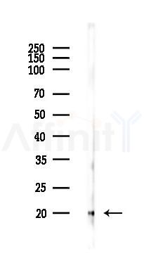 Acetyl-Histone H3 (Lys27) Recombinant Rabbit mAb - Western blot analysis of lysates from PC12 cells(LPS 4h treatment), using Acetyl-Histone H3 (Lys27) Recombinant Rabbit mAb at 1/1000 dilution.