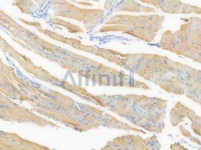 Smad2 Recombinant Rabbit mAb - BF3959 at 1/100 staining Mouse skeletal muscle tissue by IHC-P.