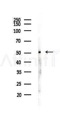 Smad2 Recombinant Rabbit mAb - Western blot analysis of lysates from Mouse testis, using Smad2 Recombinant Rabbit mAb at 1/1000 dilution.
