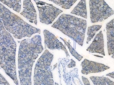 p38 MAPK Recombinant Rabbit mAb - BF3960 at 1/100 staining Rat pancreatic tissue by IHC-P.