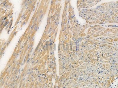 TOMM20 Recombinant Rabbit mAb - BF3961 at 1/100 staining Mouse heart tissue by IHC-P.