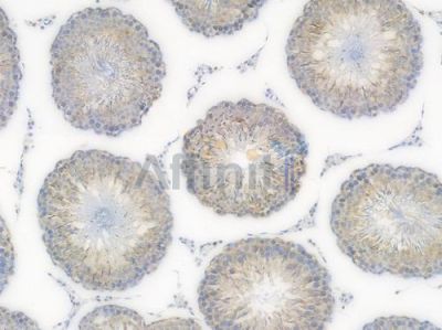 TOMM20 Recombinant Rabbit mAb - BF3961 at 1/100 staining Rat testicular tissue by IHC-P.