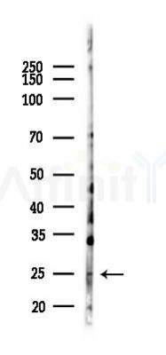 CD227/MUC1 Recombinant Rabbit mAb - Western blot analysis of lysates from Mouse testis, using CD227/MUC1 Recombinant Rabbit mAb at 1/1000 dilution.