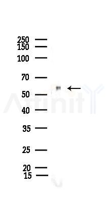 STIP1 Recombinant Rabbit mAb - Western blot analysis of lysates from Rat spleen, using STIP1 Recombinant Rabbit mAb at 1/1000 dilution.