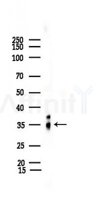 Caspase 3 Recombinant Rabbit mAb - Western blot analysis of lysates from Mouse testis, using Caspase 3 Recombinant Rabbit mAb at 1/1000 dilution.