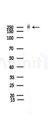 POLR2A Recombinant Rabbit mAb - Western blot analysis of lysates from RAW264.