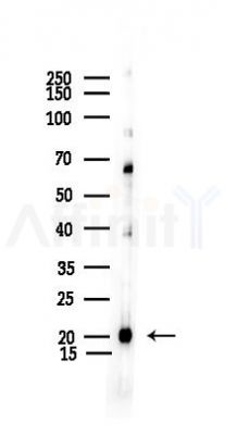 SOD1 Recombinant Rabbit mAb - Western blot analysis of lysates from Mouse testis, using SOD1 Recombinant Rabbit mAb at 1/1000 dilution.