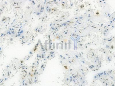 Lamin A/C Recombinant Rabbit mAb - BF3968 at 1/100 staining Human lung tissue by IHC-P.