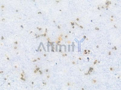 Lamin A/C Recombinant Rabbit mAb - BF3968 at 1/100 staining Human brain tissue by IHC-P.