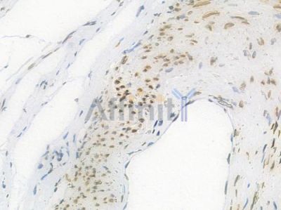 Lamin A/C Recombinant Rabbit mAb - BF3968 at 1/100 staining Human ovarian tissue by IHC-P.