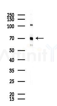 Lamin A/C Recombinant Rabbit mAb - Western blot analysis of lysates from Hela cells(heat-shock 45min treatment), using Lamin A/C Recombinant Rabbit mAb at 1/1000 dilution.