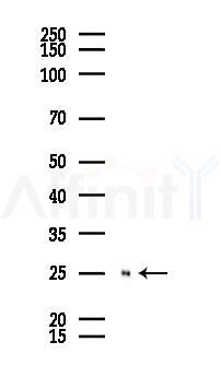 Caveolin 1 Recombinant Rabbit mAb - Western blot analysis of lysates from Mouse lung, using Caveolin 1 Recombinant Rabbit mAb at 1/1000 dilution.