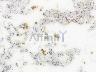 TSPO Recombinant Rabbit mAb - BF3970 at 1/100 staining Human lung tissue by IHC-P.