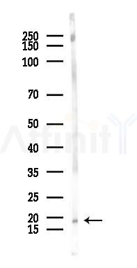 TSPO Recombinant Rabbit mAb - Western blot analysis of lysates from Mouse kidney, using TSPO Recombinant Rabbit mAb at 1/1000 dilution.