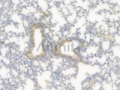 Lactate Dehydrogenase Recombinant Rabbit mAb - BF3972 at 1/100 staining Mouse lung tissue by IHC-P.