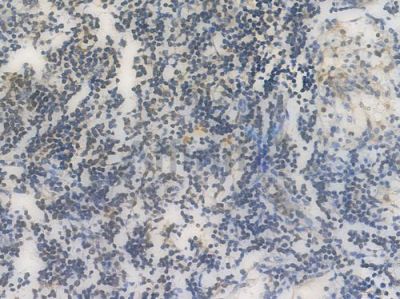 ARPC5 Recombinant Rabbit mAb - BF3973 at 1/100 staining Human lymph node tissue by IHC-P.