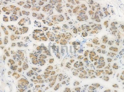 CD166 Recombinant Rabbit mAb - BF3975 at 1/100 staining Human pancreatic tissue by IHC-P.