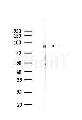 CD166 Recombinant Rabbit mAb - Western blot analysis of lysates from Mouse lung, using CD166 Recombinant Rabbit mAb at 1/1000 dilution.