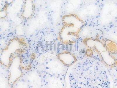 TACD2 Recombinant Rabbit mAb - BF3976 at 1/100 staining Human renal tissue by IHC-P.