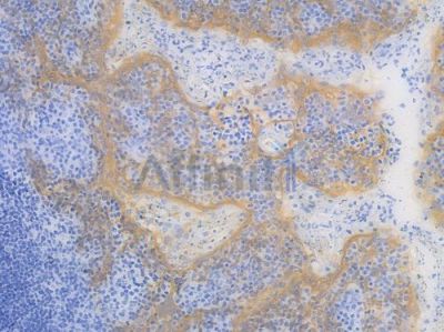 TACD2 Recombinant Rabbit mAb - BF3976 at 1/100 staining Human tonsil tissue by IHC-P.