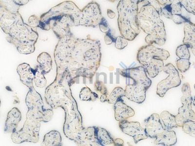 Rab5A Recombinant Rabbit mAb - BF3977 at 1/100 staining Human placental tissue by IHC-P.