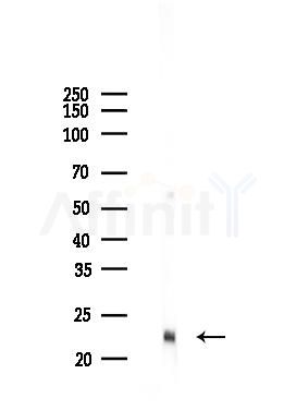 Rab5A Recombinant Rabbit mAb - Western blot analysis of lysates from Mouse testis, using Rab5A Recombinant Rabbit mAb at 1/1000 dilution.
