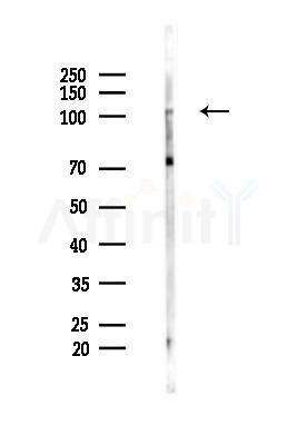 USP10 Recombinant Rabbit mAb - Western blot analysis of lysates from Mouse lung, using USP10 Recombinant Rabbit mAb at 1/1000 dilution.