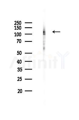 SIRT1 Recombinant Rabbit mAb - Western blot analysis of lysates from Mouse testis, using SIRT1 Recombinant Rabbit mAb at 1/1000 dilution.