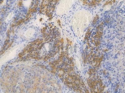 ATP2A2 Recombinant Rabbit mAb - BF3981 at 1/100 staining Rat spleen tissue by IHC-P.