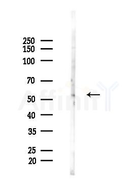 PNPLA2 Recombinant Rabbit mAb - Western blot analysis of lysates from B16F10-LUC cells(heat-shock 45min treatment), using PNPLA2 Recombinant Rabbit mAb at 1/1000 dilution.