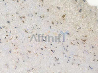 Citrate synthetase Recombinant Rabbit mAb - BF3986 at 1/100 staining Human brain tissue by IHC-P.