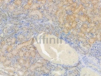 PAX8 Recombinant Rabbit mAb - BF3988 at 1/100 staining Rat renal tissue by IHC-P.