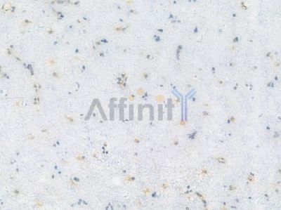 GSTP1 Recombinant Rabbit mAb - BF3989 at 1/100 staining Human brain tissue by IHC-P.