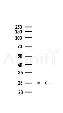 GSTP1 Recombinant Rabbit mAb - Western blot analysis of lysates from Mouse kidney, using GSTP1 Recombinant Rabbit mAb at 1/1000 dilution.