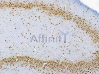 DDX5 Recombinant Rabbit mAb - BF3993 at 1/100 staining Rat brain tissue by IHC-P.