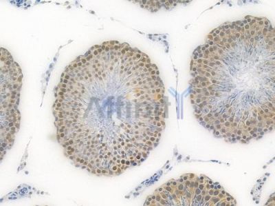 DDX5 Recombinant Rabbit mAb - BF3993 at 1/100 staining Rat testicular tissue by IHC-P.