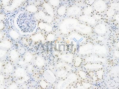 DDX5 Recombinant Rabbit mAb - BF3993 at 1/100 staining Human renal tissue by IHC-P.
