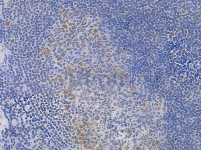 DDX5 Recombinant Rabbit mAb - BF3993 at 1/100 staining Human tonsil tissue by IHC-P.