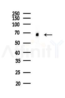 DDX5 Recombinant Rabbit mAb - Western blot analysis of lysates from PC12 cells(UV 30min treatment), using DDX5 Recombinant Rabbit mAb at 1/1000 dilution.