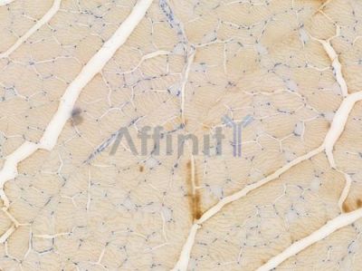ACTN3 Recombinant Rabbit mAb - BF3995 at 1/100 staining Rat renal tissue by IHC-P.